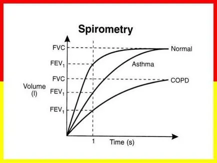 Spirometria - egy