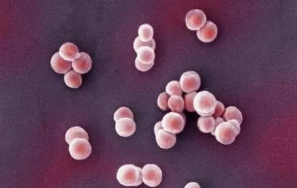 Staphylococcus mi ez, és milyen veszélyes