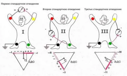 A technológia az EKG - studopediya