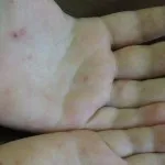 Shakes az egész test okozza, okozza és a kezelés minősített válasz