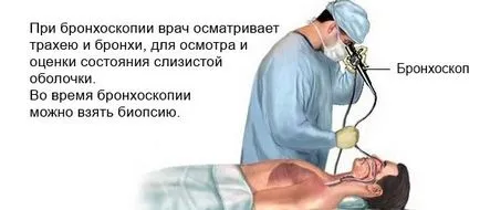 Tracheobronchitis - formák, okok, tünetek és a kezelés