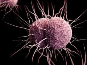 Mi gonorrhoea férfiak Mi gonorrhoea férfiak
