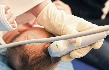 Doppler ultrahang hajók a fej és nyak, jelezve, hogy ez az ár