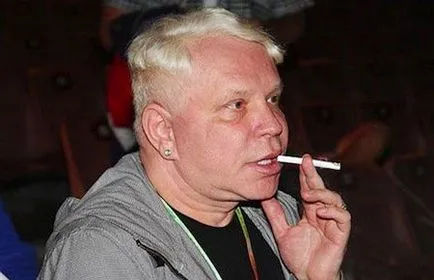 Doppler ultrahang hajók a fej és nyak, jelezve, hogy ez az ár