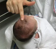 Mennyire egészséges az újszülött baba tudni a babáról, megy a kórházba (szükség esetén) Mennyire egészséges az újszülött baba tudni a babáról, majd a kórházba