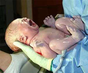Mennyire egészséges az újszülött baba tudni a babáról, megy a kórházba (egészséges) Mennyire egészséges az újszülött baba tudni a babáról, majd a kórházba