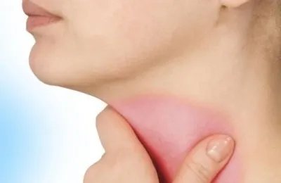 Hogyan lehet gyorsan megszabadulni a torokfájás