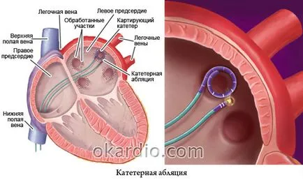 Bigemini hogy mi az Bigemini hogy mi az