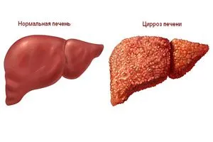 Hepatitis hogy lehet enni
