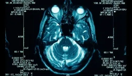 Hydrocephalus kezelése népi jogorvoslati Hydrocephalus kezelése népi jogorvoslati