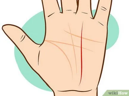 Hand mit képvisel