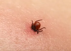 Hogyan vonjuk ki a kullancs