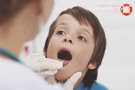 Hogyan lehet gyorsan megszabadulni a torokfájás Hogyan lehet gyorsan megszabadulni a torokfájás