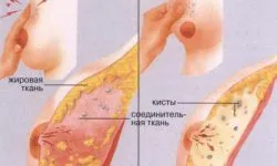Mi rostos breast Mi rostos breast