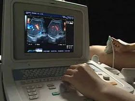Mi a Doppler Mi a Doppler