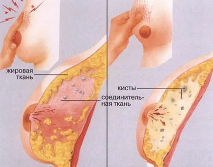 Mi rostos breast Mi rostos breast
