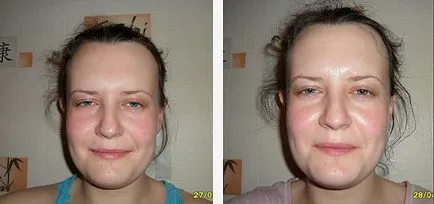Hogyan készítsünk egy otthon peeling Hogyan készítsünk egy otthon peeling