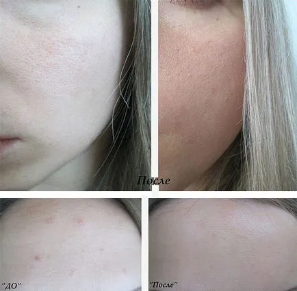 Hogyan készítsünk egy otthon peeling Hogyan készítsünk egy otthon peeling