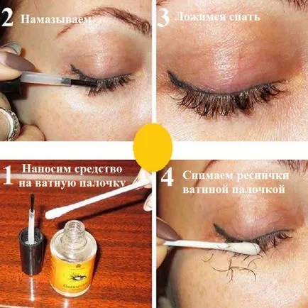 Hogyan kell telepíteni az elsődleges zónát