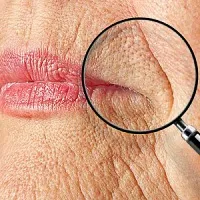 DNS Gardnerella vaginalis ez DNS Gardnerella vaginalis ez