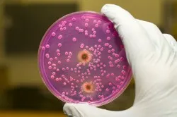DNS Gardnerella vaginalis ez DNS Gardnerella vaginalis ez