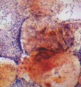 DNS Gardnerella vaginalis ez DNS Gardnerella vaginalis ez