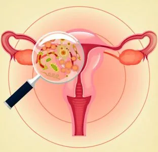 DNS Gardnerella vaginalis ez DNS Gardnerella vaginalis ez