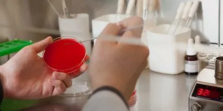 Mi gonorrhoea férfiak