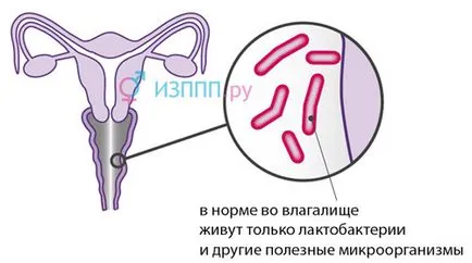 DNS Gardnerella vaginalis ez DNS Gardnerella vaginalis ez