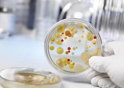 DNS Gardnerella vaginalis ez DNS Gardnerella vaginalis ez