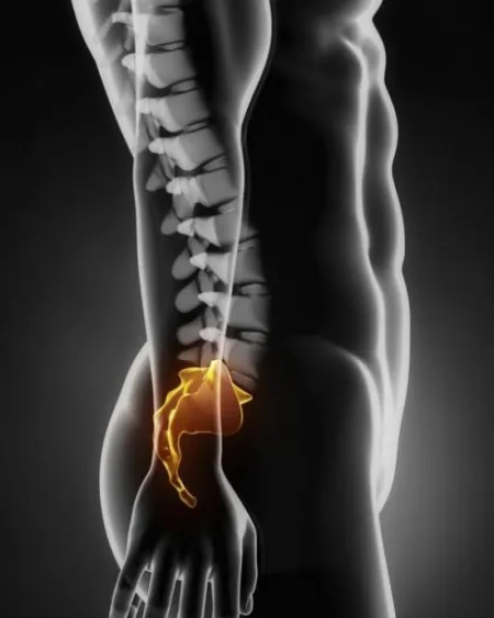 Mert amit a tailbone ciszta