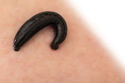 Hogy a kezelt piócák Hogy a kezelt piócák