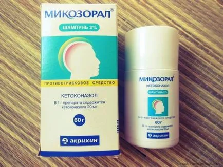 Mi a legjobb sampon korpásodás