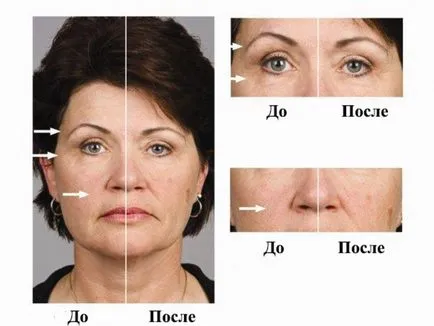 Mik a mikro-áram kozmetológiai Mik a mikro-áram kozmetológiai
