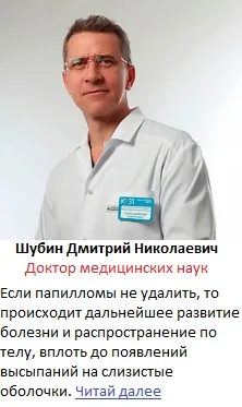 Hogyan megvédeni ellenségei ellen Hogyan megvédeni ellenségei ellen