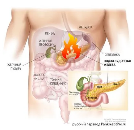 Mi pancreatitis a hasnyálmirigy