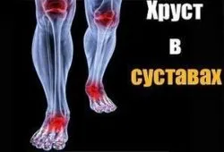 polyosteoarthrosis kezelés