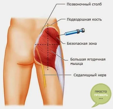 Hogyan szúrt az emberek