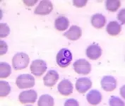 Lyme-kór a kutyák Lyme-kór a kutyák