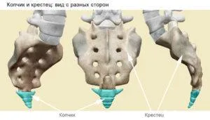Coccyx fájdalom, mint a kezelésére Coccyx fájdalom, mint a kezelésére
