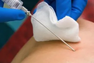 Elemzés a biopsziák amelyre Elemzés a biopsziák amelyre