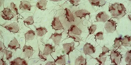 Reakcióvázlat kezelésére trichomoniasis Reakcióvázlat kezelésére trichomoniasis