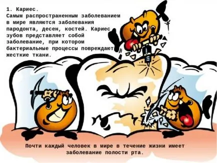 A kúra fogszuvasodás