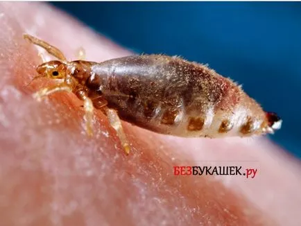 Hogyan lehet megszabadulni a tetvek a gyermek