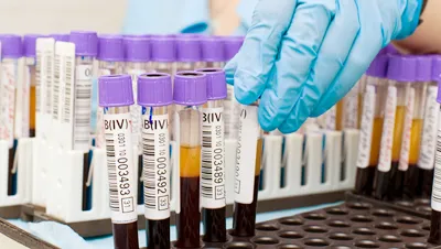 biokémiai diagnosztika biokémiai diagnosztika