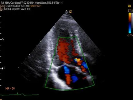 Módszerek funkcionális diagnosztikához Módszerek funkcionális diagnosztikához