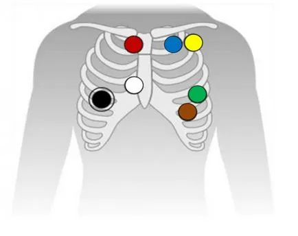 Módszerek funkcionális diagnosztikához Módszerek funkcionális diagnosztikához