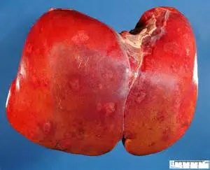 Cure alkoholizmus otthon