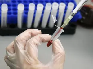 Hogyan lehet megérteni az eredményeket Diaskintest