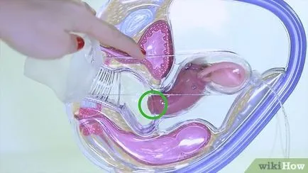 Hogyan kell használni a menstruációs csésze
